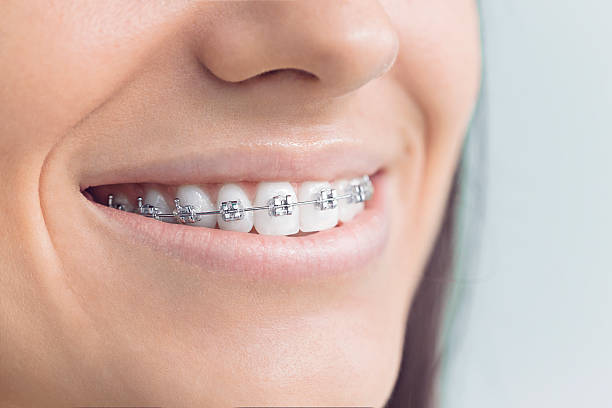 Why Choose Us for Your Dental Needs in Wanakah, NY